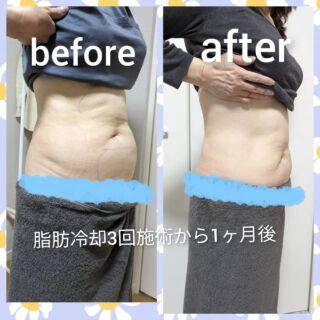 導入機械について – Body Shape Kanau